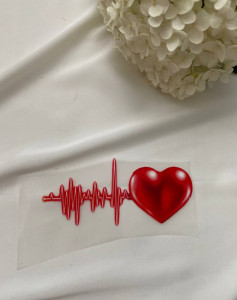 Термоналіпка ритм серця