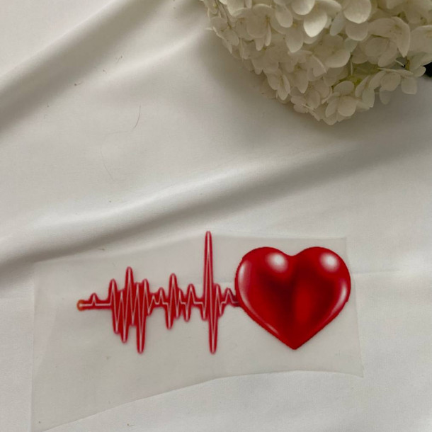 Термоналіпка ритм серця